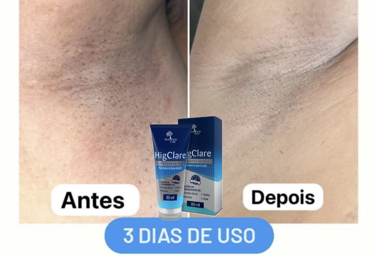 Como clarear axilas e virilhas rápido . 